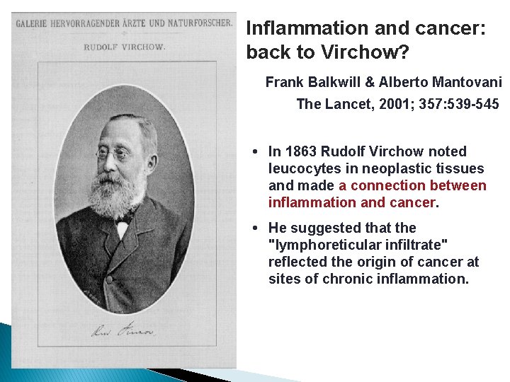 Inflammation and cancer: back to Virchow? Frank Balkwill & Alberto Mantovani The Lancet, 2001;