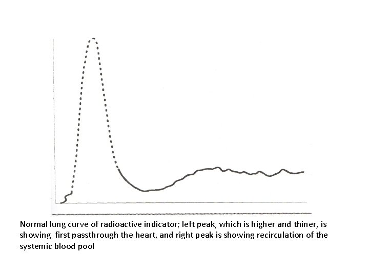 Normal lung curve of radioactive indicator; left peak, which is higher and thiner, is
