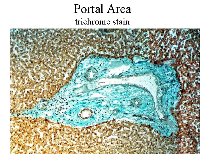 Portal Area trichrome stain 