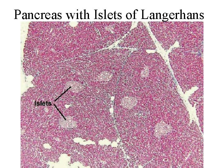 Pancreas with Islets of Langerhans 