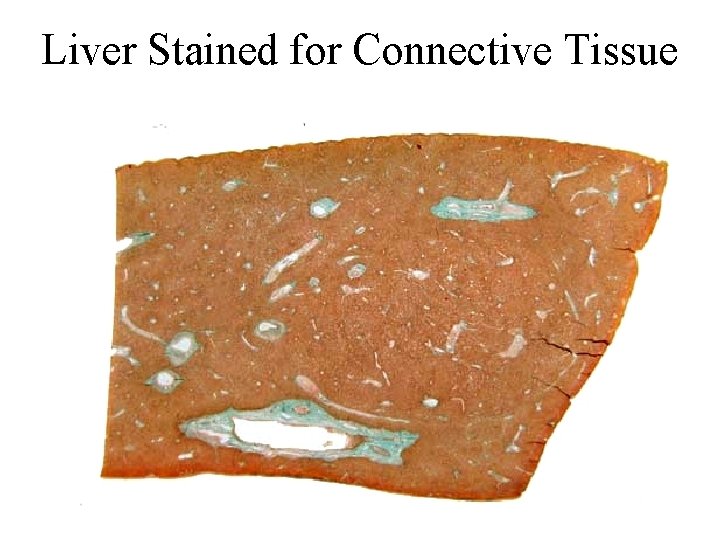 Liver Stained for Connective Tissue 