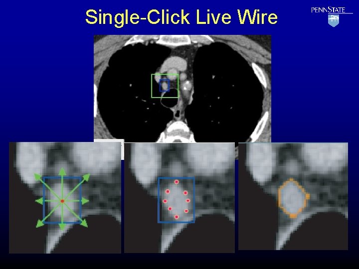 Single-Click Live Wire 