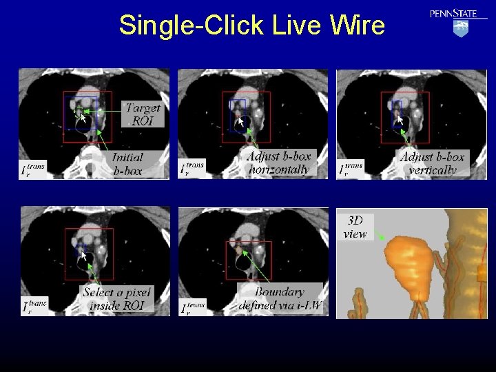 Single-Click Live Wire 
