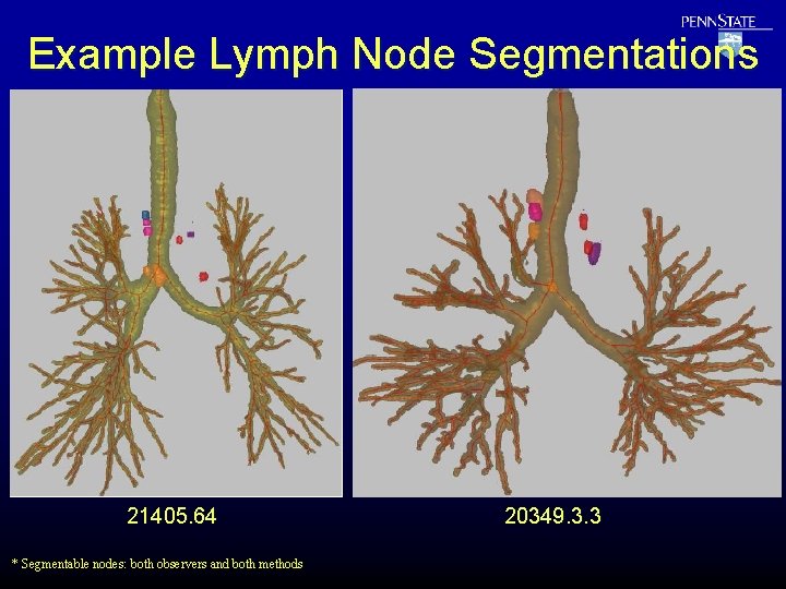 Example Lymph Node Segmentations 21405. 64 * Segmentable nodes: both observers and both methods