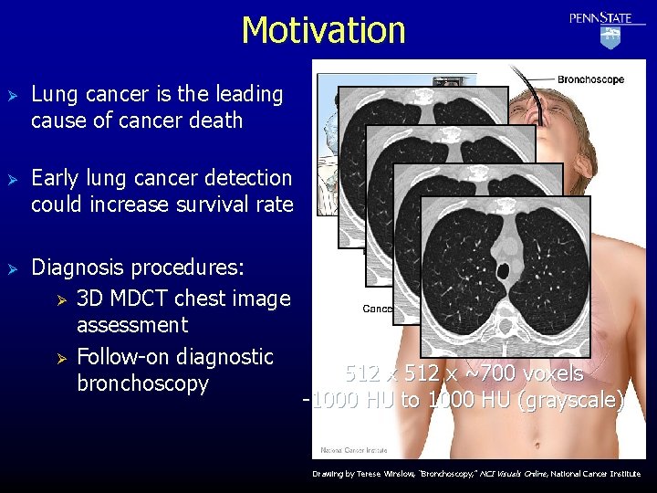 Motivation Ø Ø Ø Lung cancer is the leading cause of cancer death Early