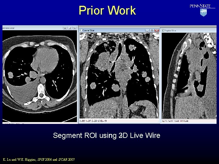 Prior Work Segment ROI using 3 D 2 D Live Wire K. Lu and