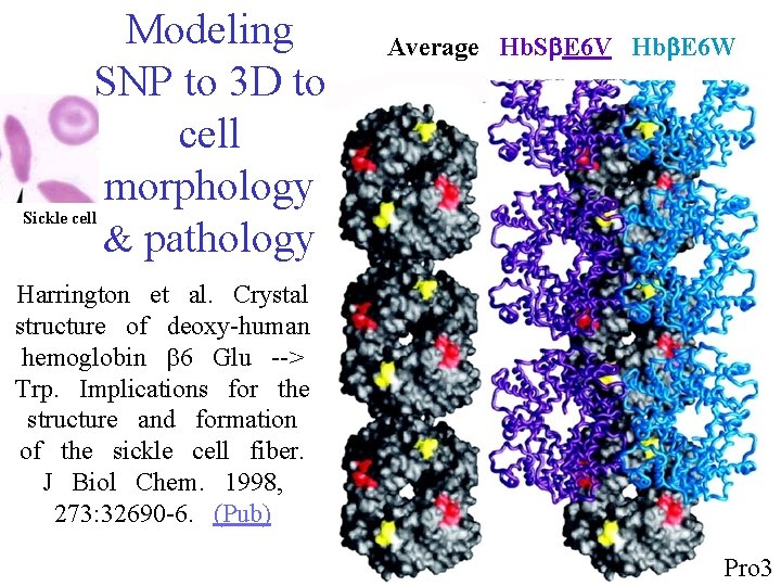 Modeling SNP to 3 D to cell morphology & pathology Average Hb. Sb. E