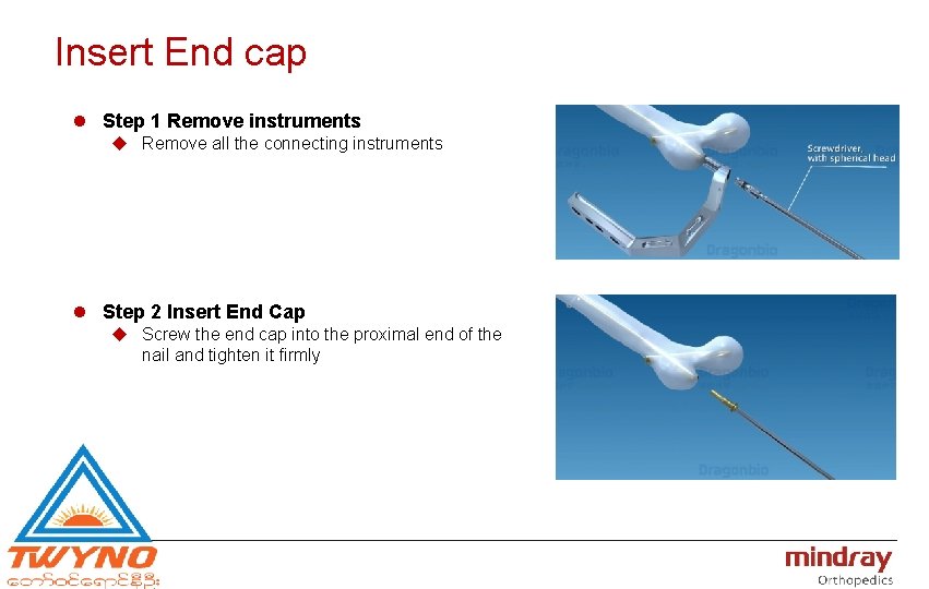 Insert End cap l Step 1 Remove instruments u Remove all the connecting instruments
