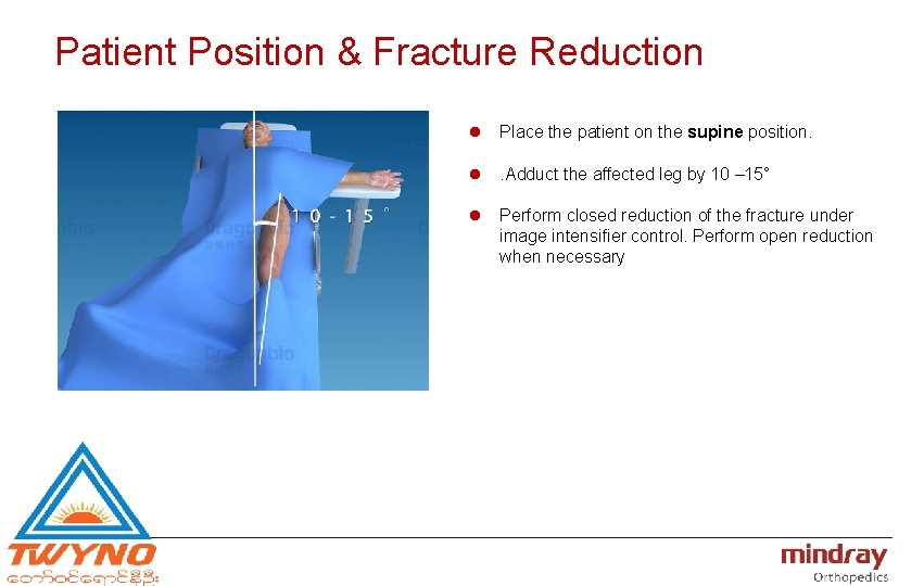 Patient Position & Fracture Reduction l Place the patient on the supine position. l.