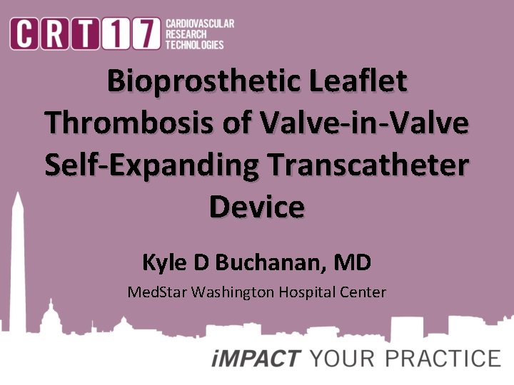 Bioprosthetic Leaflet Thrombosis of Valve-in-Valve Self-Expanding Transcatheter Device Kyle D Buchanan, MD Med. Star