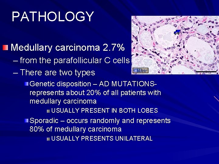 PATHOLOGY Medullary carcinoma 2. 7% – from the parafollicular C cells – There are PATHOLOGY Medullary carcinoma 2. 7% – from the parafollicular C cells – There are