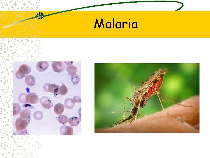 Malaria 