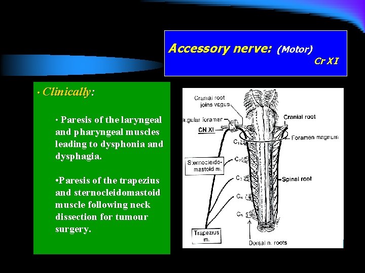 Accessory nerve: • Clinically: • Paresis of the laryngeal and pharyngeal muscles leading to