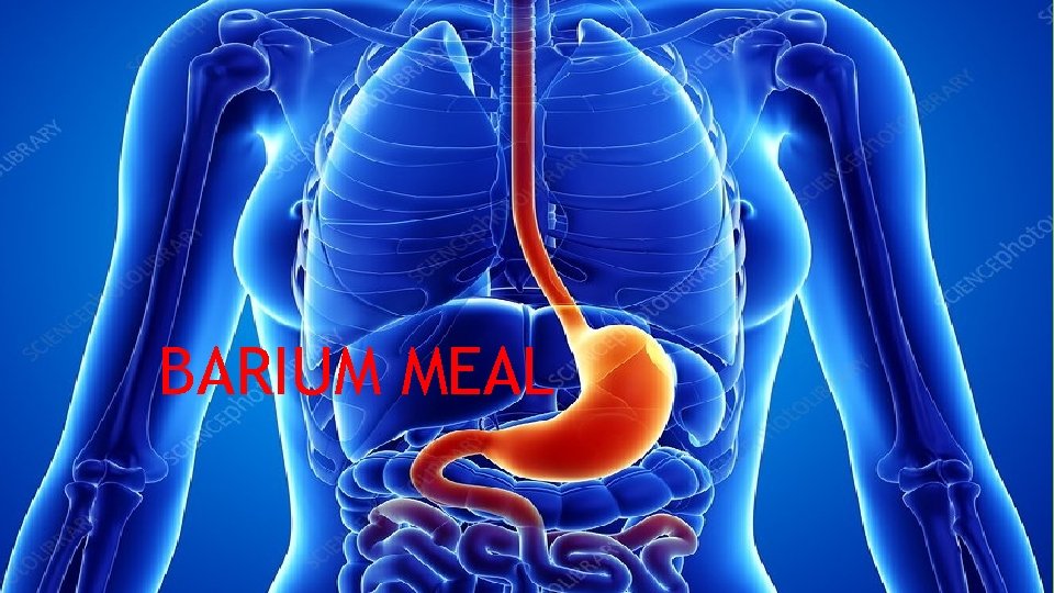 BARIUM MEAL Barium meal 