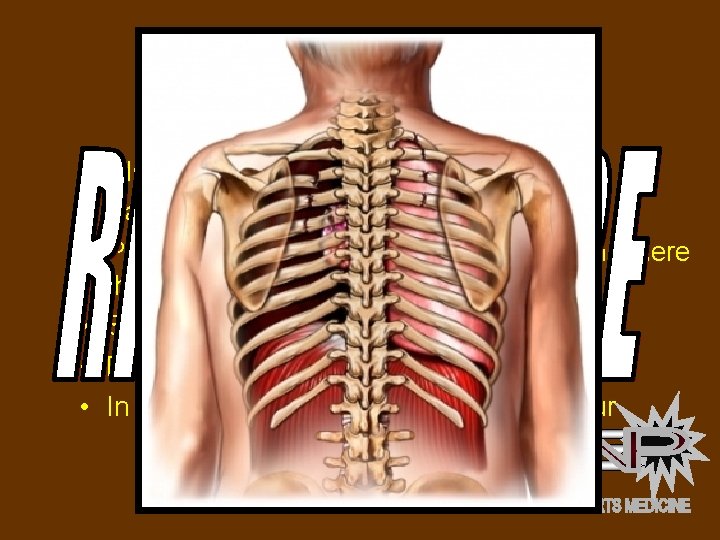 RIB FRACTURE • SIGNS AND SYMPTOMS: • Pain when breathing • Possibly a protruding