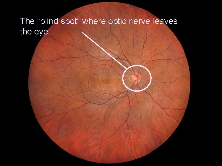 The “blind spot” where optic nerve leaves the eye 