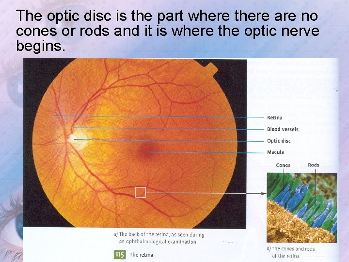 The optic disc is the part where there are no cones or rods and