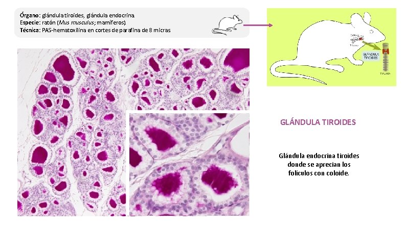 Órgano: glándula tiroides, glándula endocrina. Especie: ratón (Mus musculus; mamíferos). Técnica: PAS-hematoxilina en cortes