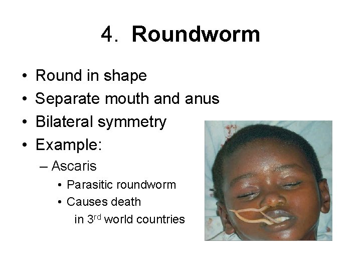 4. Roundworm • • Round in shape Separate mouth and anus Bilateral symmetry Example: