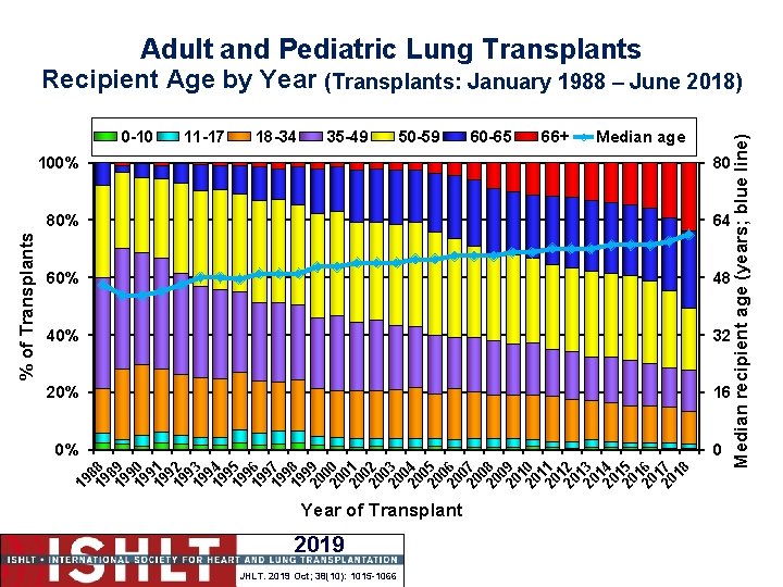 Adult and Pediatric Lung Transplants 11 -17 18 -34 35 -49 50 -59 60