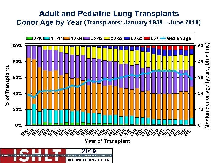 Adult and Pediatric Lung Transplants Donor Age by Year (Transplants: January 1988 – June