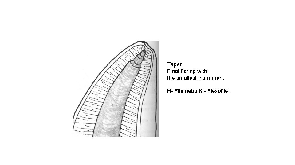 Taper Final flaring with the smallest instrument H- File nebo K - Flexofile. 