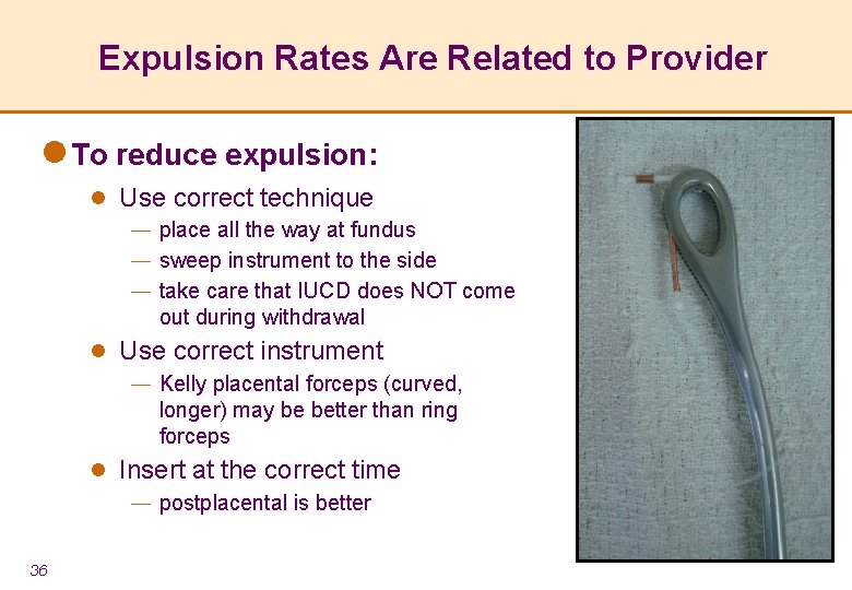 Expulsion Rates Are Related to Provider l To reduce expulsion: l Use correct technique