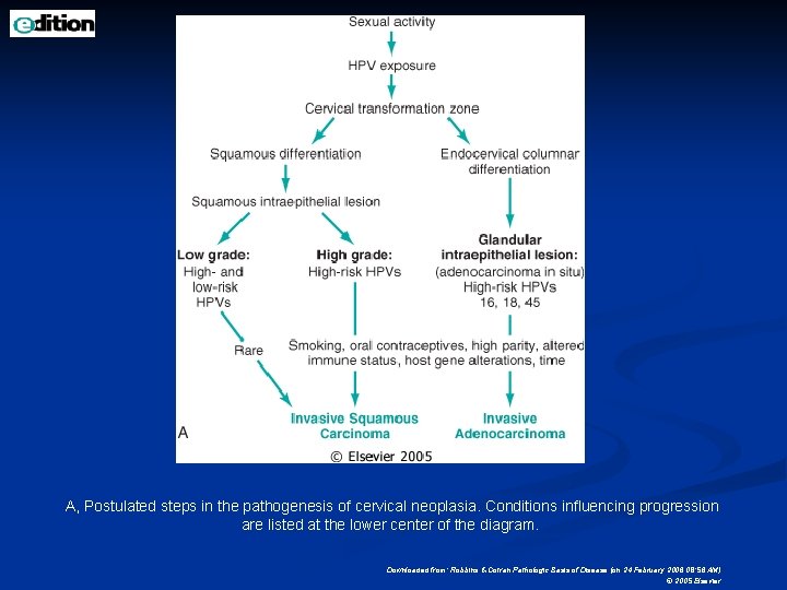 A, Postulated steps in the pathogenesis of cervical neoplasia. Conditions influencing progression are listed