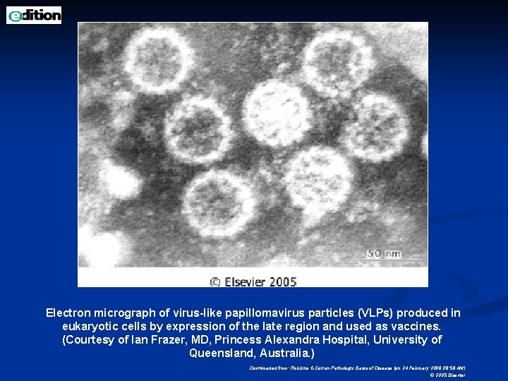 Electron micrograph of virus-like papillomavirus particles (VLPs) produced in eukaryotic cells by expression of