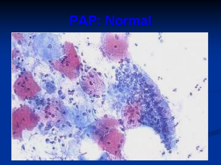 PAP: Normal 