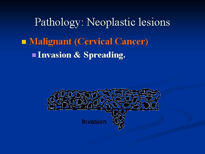Pathology: Neoplastic lesions n Malignant (Cervical Cancer) n Invasion & Spreading. 