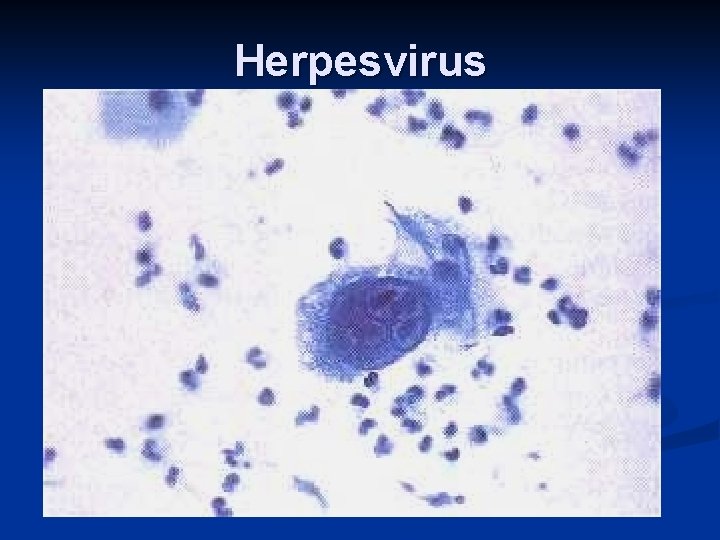 Herpesvirus 