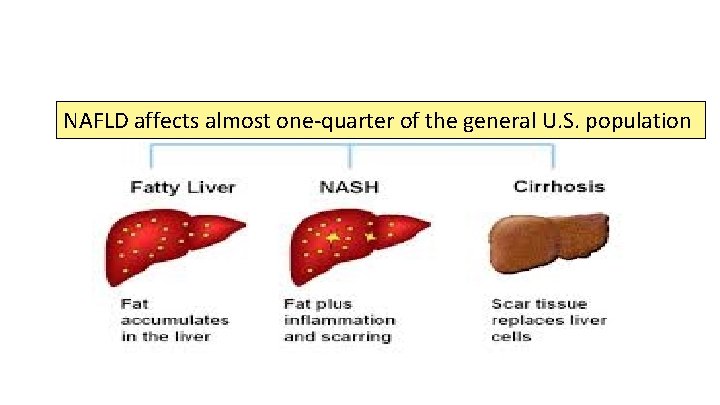NAFLD affects almost one-quarter of the general U. S. population 