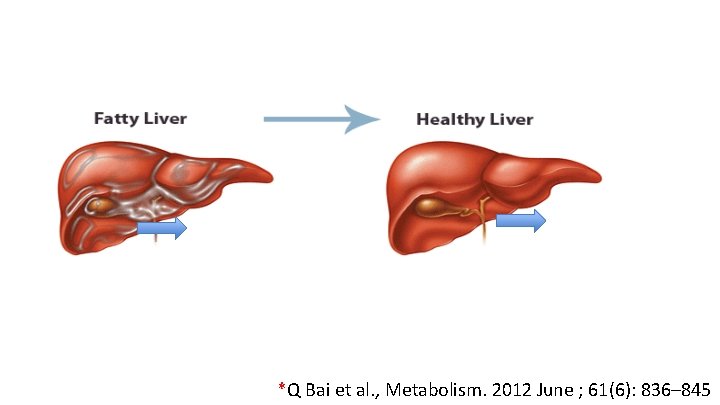 *Q Bai et al. , Metabolism. 2012 June ; 61(6): 836– 845 