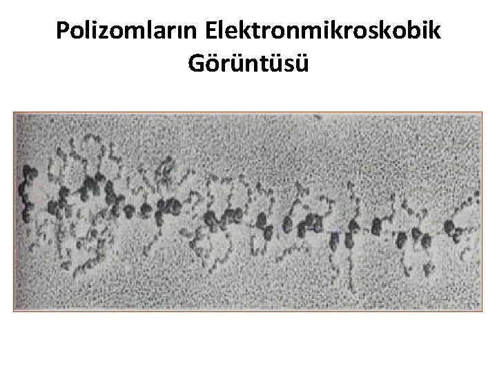 Polizomların Elektronmikroskobik Görüntüsü 