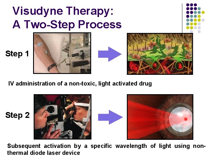 Visudyne Therapy: A Two-Step Process Step 1 IV administration of a non-toxic, light activated Visudyne Therapy: A Two-Step Process Step 1 IV administration of a non-toxic, light activated