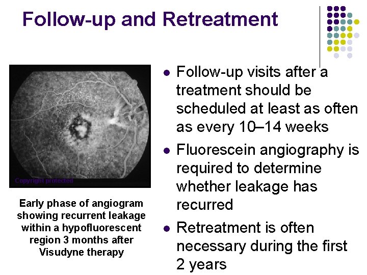 Follow-up and Retreatment l l Copyright protected Early phase of angiogram showing recurrent leakage Follow-up and Retreatment l l Copyright protected Early phase of angiogram showing recurrent leakage