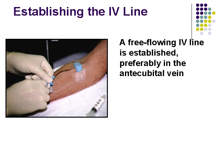 Establishing the IV Line A free-flowing IV line is established, preferably in the antecubital Establishing the IV Line A free-flowing IV line is established, preferably in the antecubital