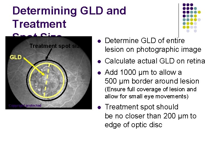 Determining GLD and Treatment Spot Size l Determine GLD of entire Treatment spot size Determining GLD and Treatment Spot Size l Determine GLD of entire Treatment spot size