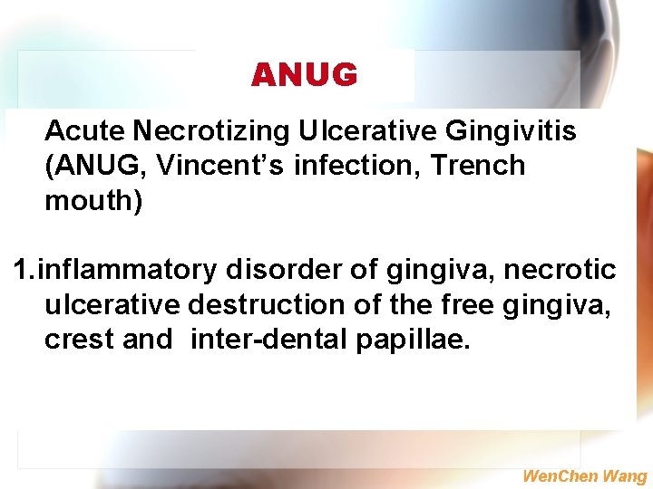 ANUG Acute Necrotizing Ulcerative Gingivitis (ANUG, Vincent’s infection, Trench mouth) 1. inflammatory disorder of