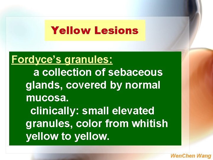 Yellow Lesions Fordyce’s granules: a collection of sebaceous glands, covered by normal mucosa. clinically: