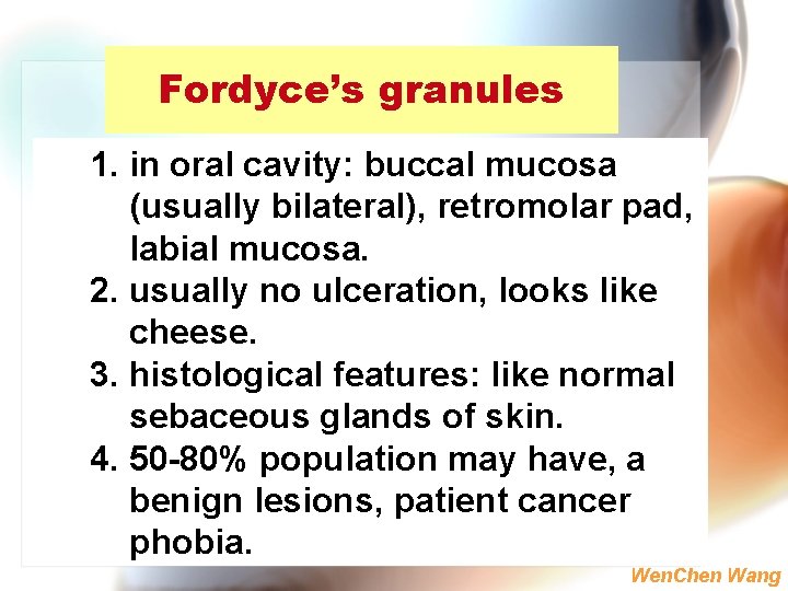 Fordyce’s granules 1. in oral cavity: buccal mucosa (usually bilateral), retromolar pad, labial mucosa.
