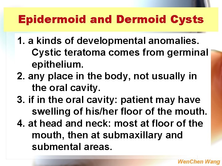 Epidermoid and Dermoid Cysts 1. a kinds of developmental anomalies. Cystic teratoma comes from