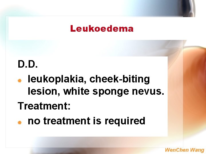 Leukoedema D. D. | leukoplakia, cheek-biting lesion, white sponge nevus. Treatment: | no treatment
