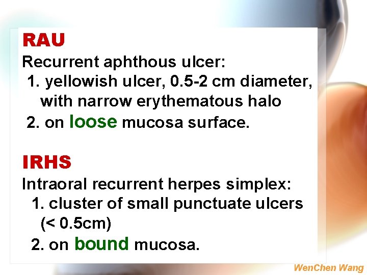 RAU Recurrent aphthous ulcer: 1. yellowish ulcer, 0. 5 -2 cm diameter, with narrow