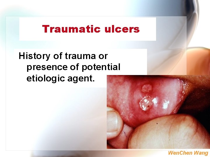 Traumatic ulcers History of trauma or presence of potential etiologic agent. Wen. Chen Wang