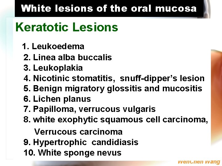 White lesions of the oral mucosa Keratotic Lesions 1. Leukoedema 2. Linea alba buccalis