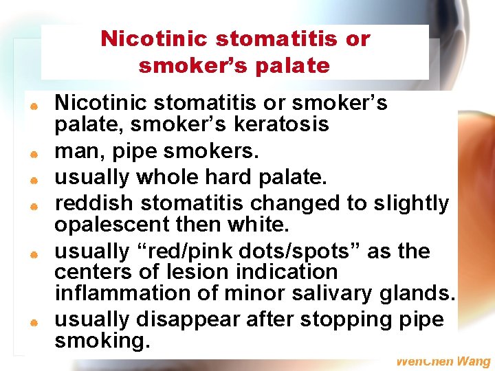 Nicotinic stomatitis or smoker’s palate | | | Nicotinic stomatitis or smoker’s palate, smoker’s