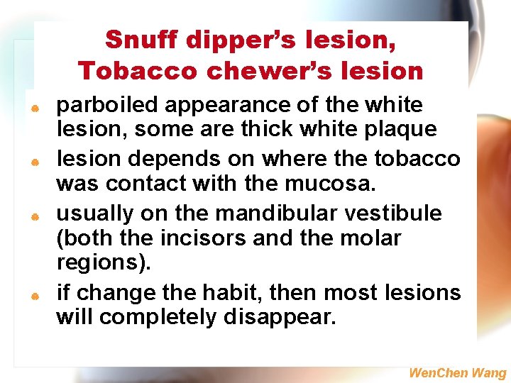 Snuff dipper’s lesion, Tobacco chewer’s lesion | | parboiled appearance of the white lesion,