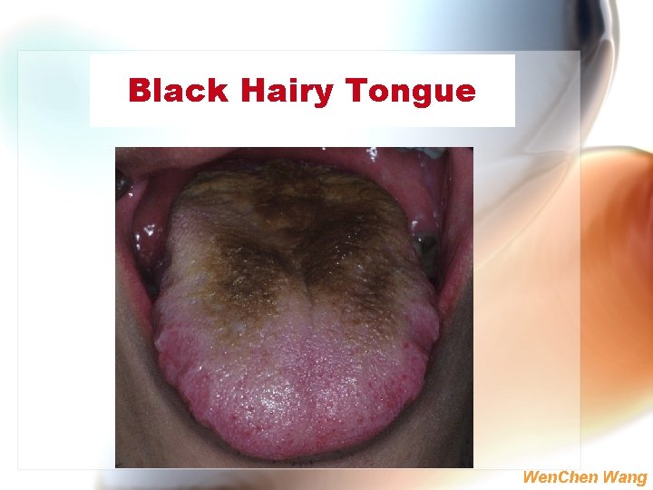 Black Hairy Tongue Wen. Chen Wang 
